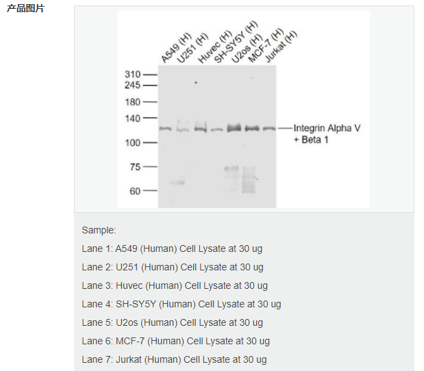 600e5ed805a78.png image.png